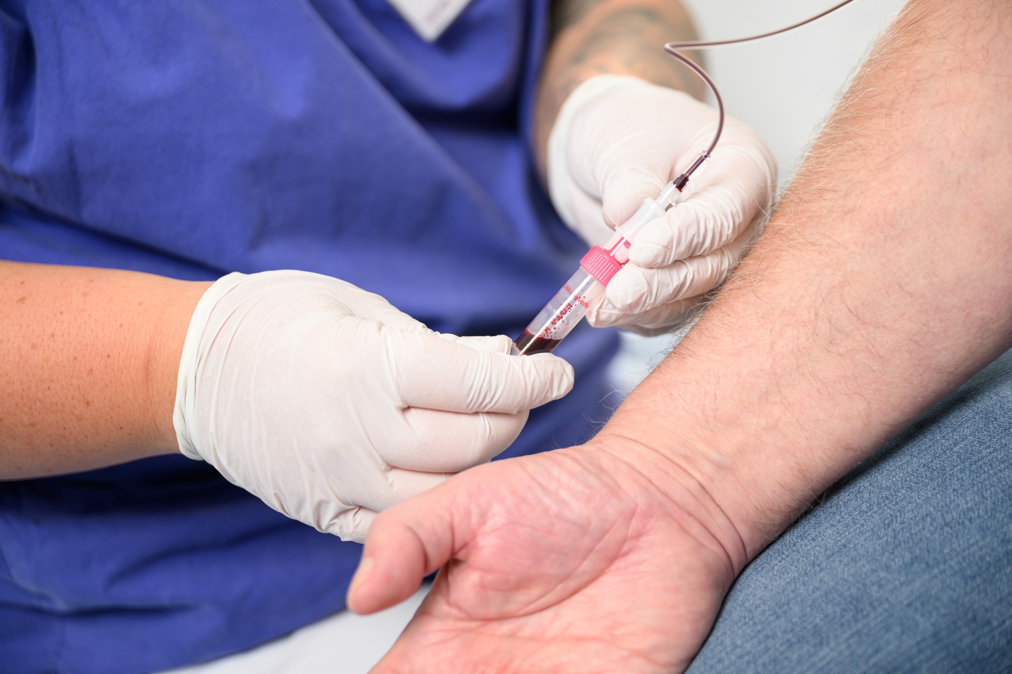 Das Bild zeigt, wie eine Pflegekraft mit Handschuhen einem Patienten Blut abnimmt. 