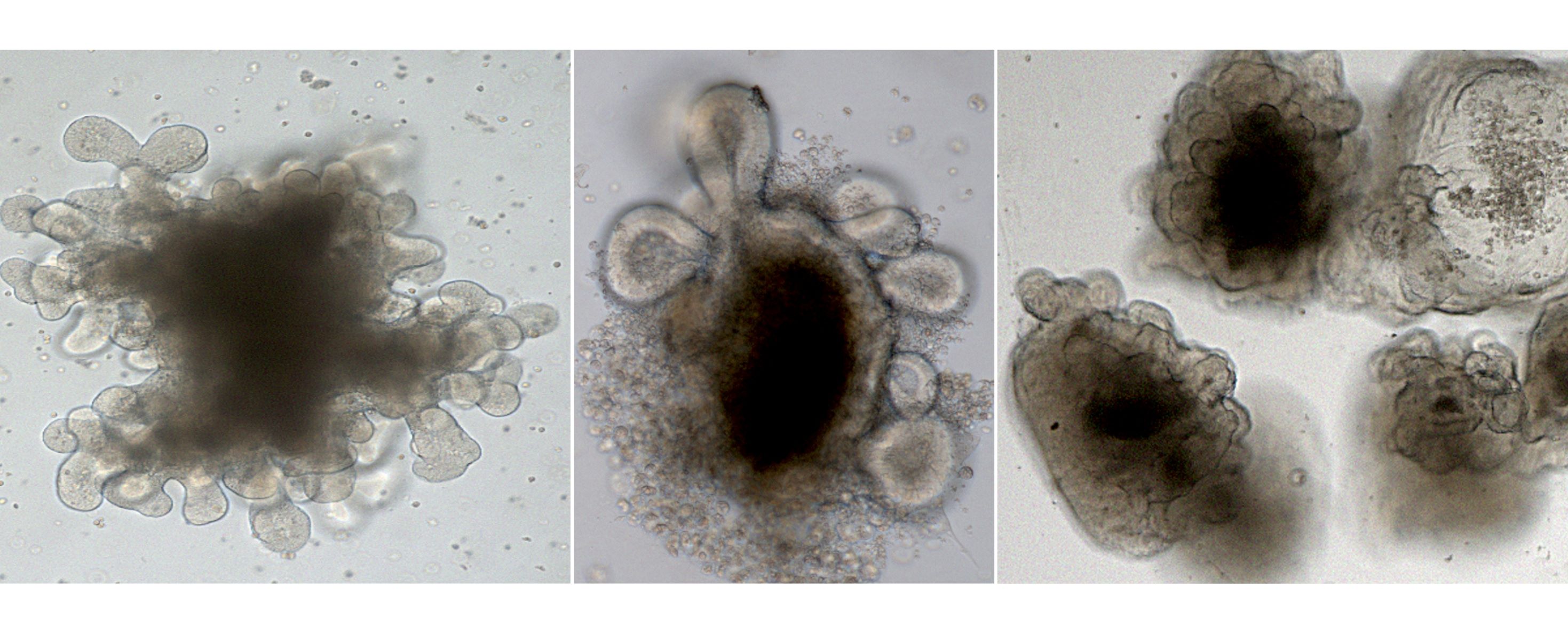 Schwarz-weiß-Aufnahmen von drei verschiedenen Organoiden 