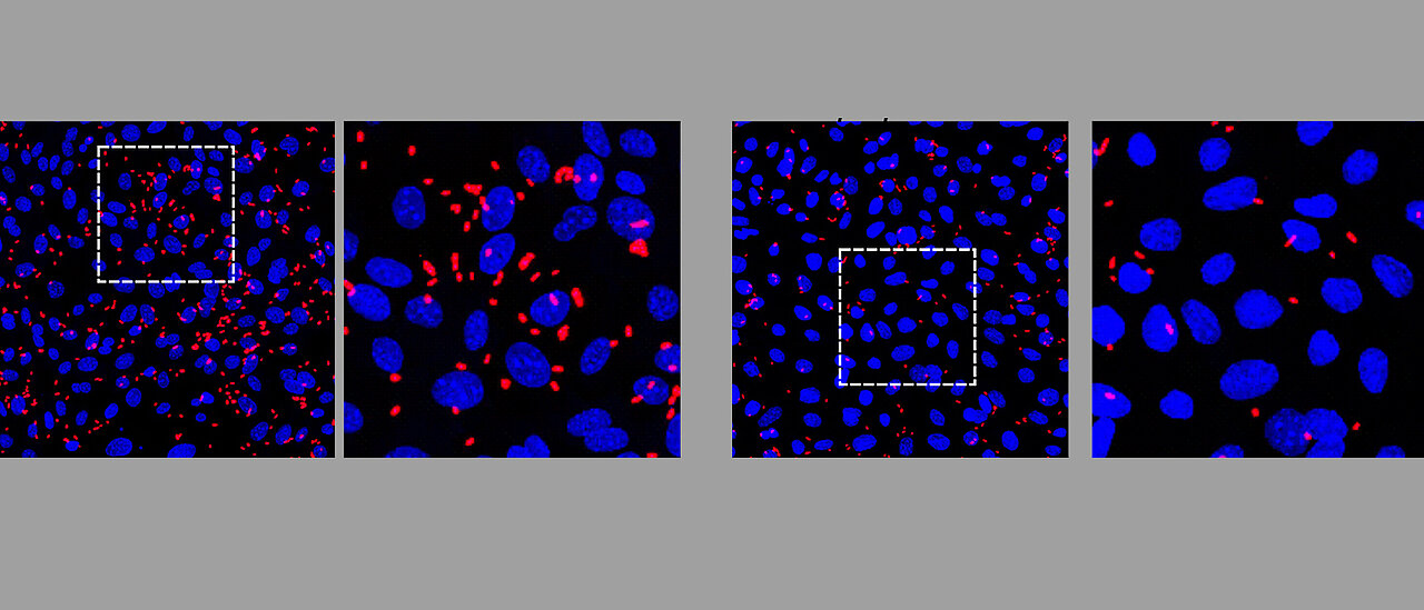 Prostata-Organoidzellen, deren PPAP-Rezeptor ausgeschaltet wurde, zeigen im Vergleich zu Wildtyp-Zellen, eine deutlich geringere Infektionsrate.