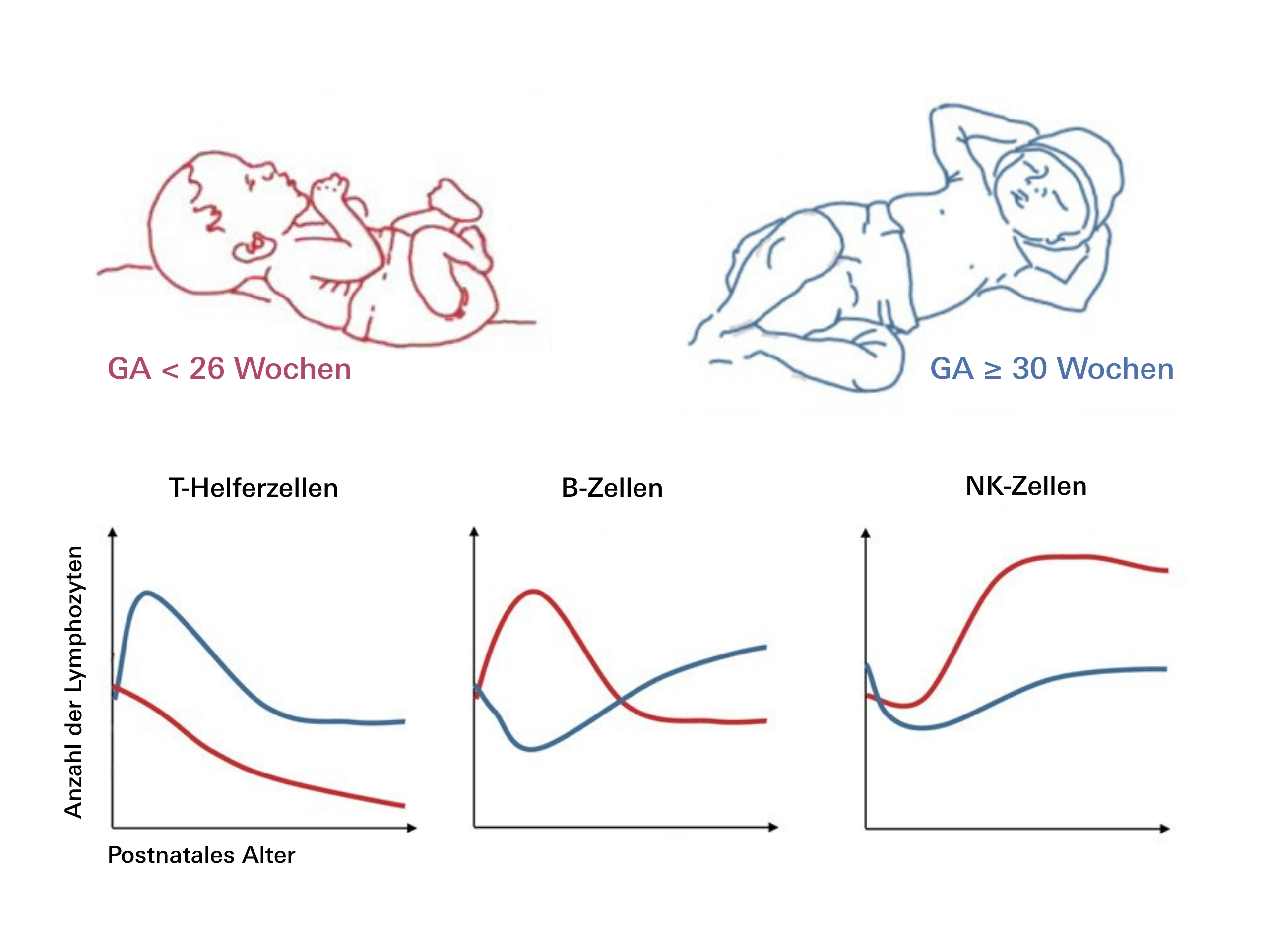 Grafik eines sehr kleinen Babys in rot und eines etwas reiferen Babys in blau sowie drei Koordinatensysteme, welche die Entwicklung von T-Helferzellen, B-Zellen und NK-Zellen zeigen (y-Achse zeigt Anzahl der Lymphozyten, x-Achse das postnatale Alter). 