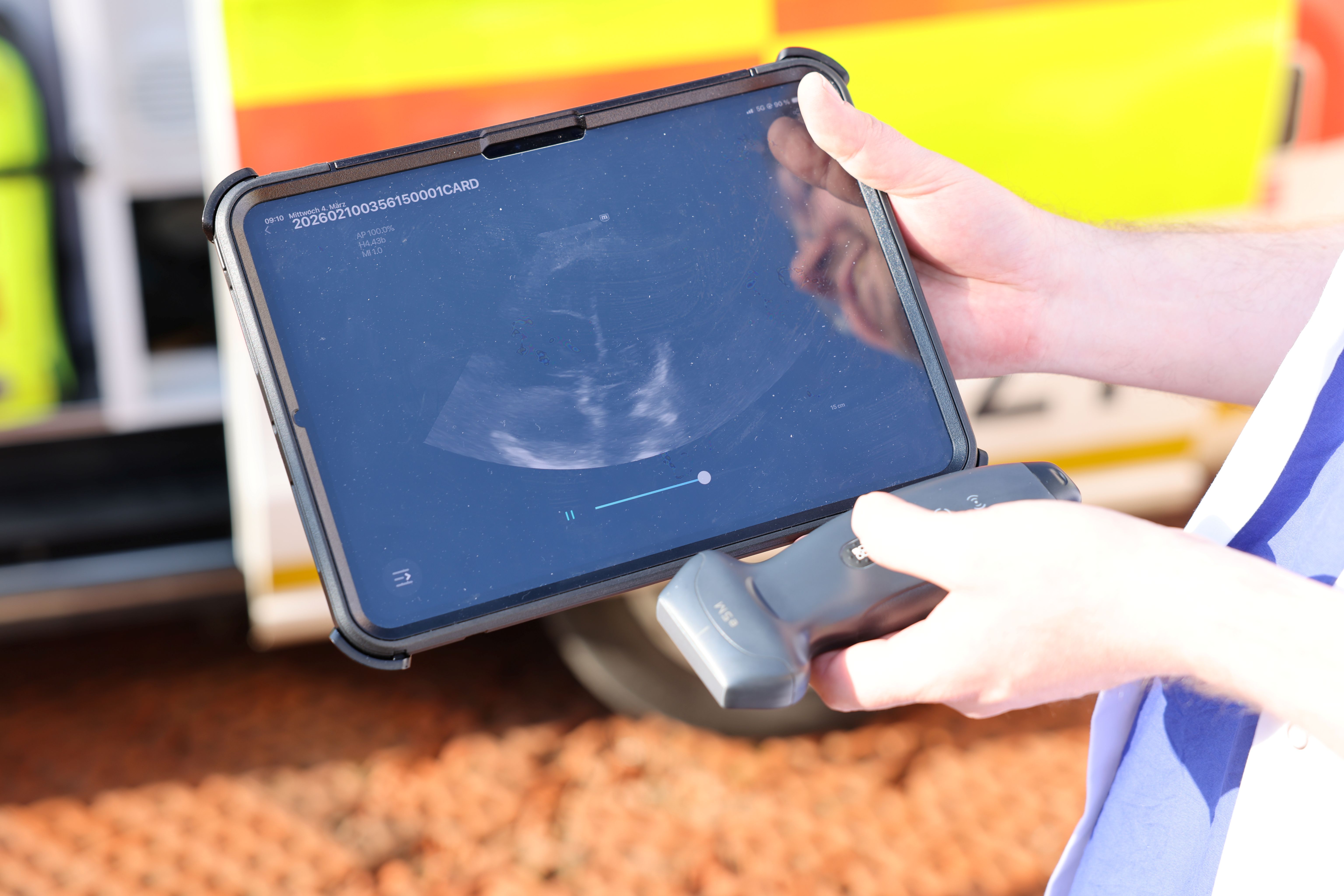 Das neue Gerät unterstützt im Rettungseinsatz dabei, lebensbedrohliche Erkrankungen bereits vor Eintreffen im Krankenhaus schneller und präziser zu erkennen. Die Aufnahmen können direkt am Einsatzort bewertet werden. Das UKW schult sowohl Notärzte als auch Notfallsanitäter gezielt für den Einsatz. Foto: UKW / Kim Sammet