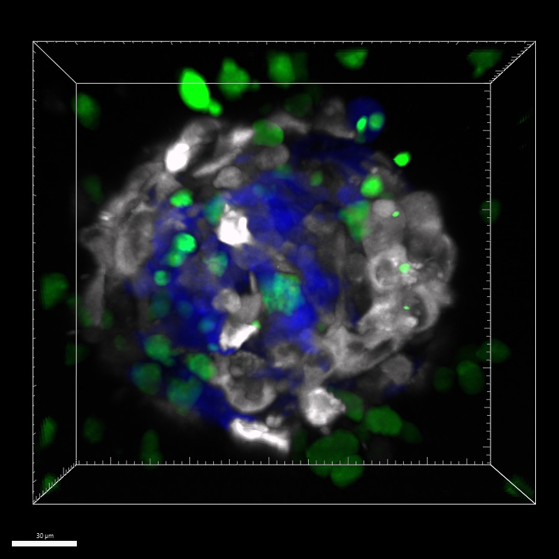 Fluoreszenz-Mikroskopiebild des 3D-KM-MM-Sphäroid
