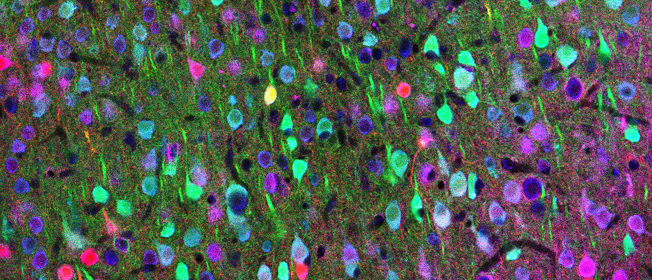 Mikroskopisches Bild zeigt verschiedene Typen von Nervenzellen in mehreren Farben als Lichtpulse an.