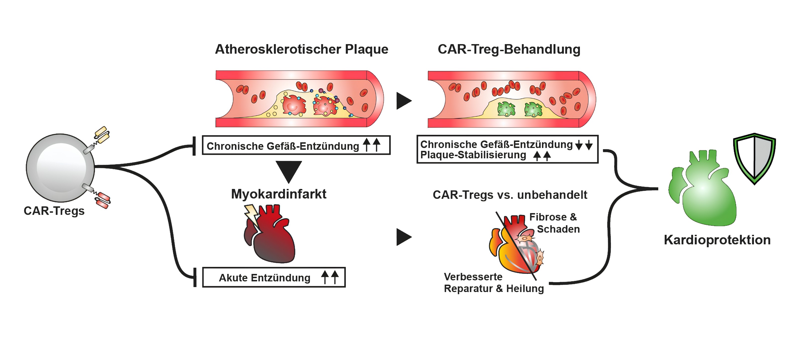Illustration - links CAR-Tregs, oberer Teil zeigt wie sie chronische Entzündungen im Gefäß bekämpfen und zur Plaque-Stabilisierung beitragen, unterer Teil, wie sie das Gewebe im Herz nach Infarkt schützen bzw. zur Heilung beitragen. Zu sehen ist eine regulatorische Zelle mit CAR, Gefäße mit Plaque und Herz nach Infarkt. 