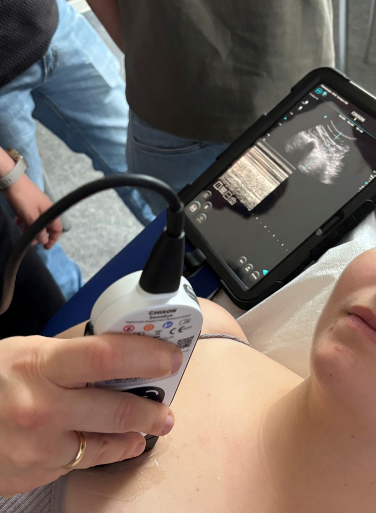 Ultraschalluntersuchung