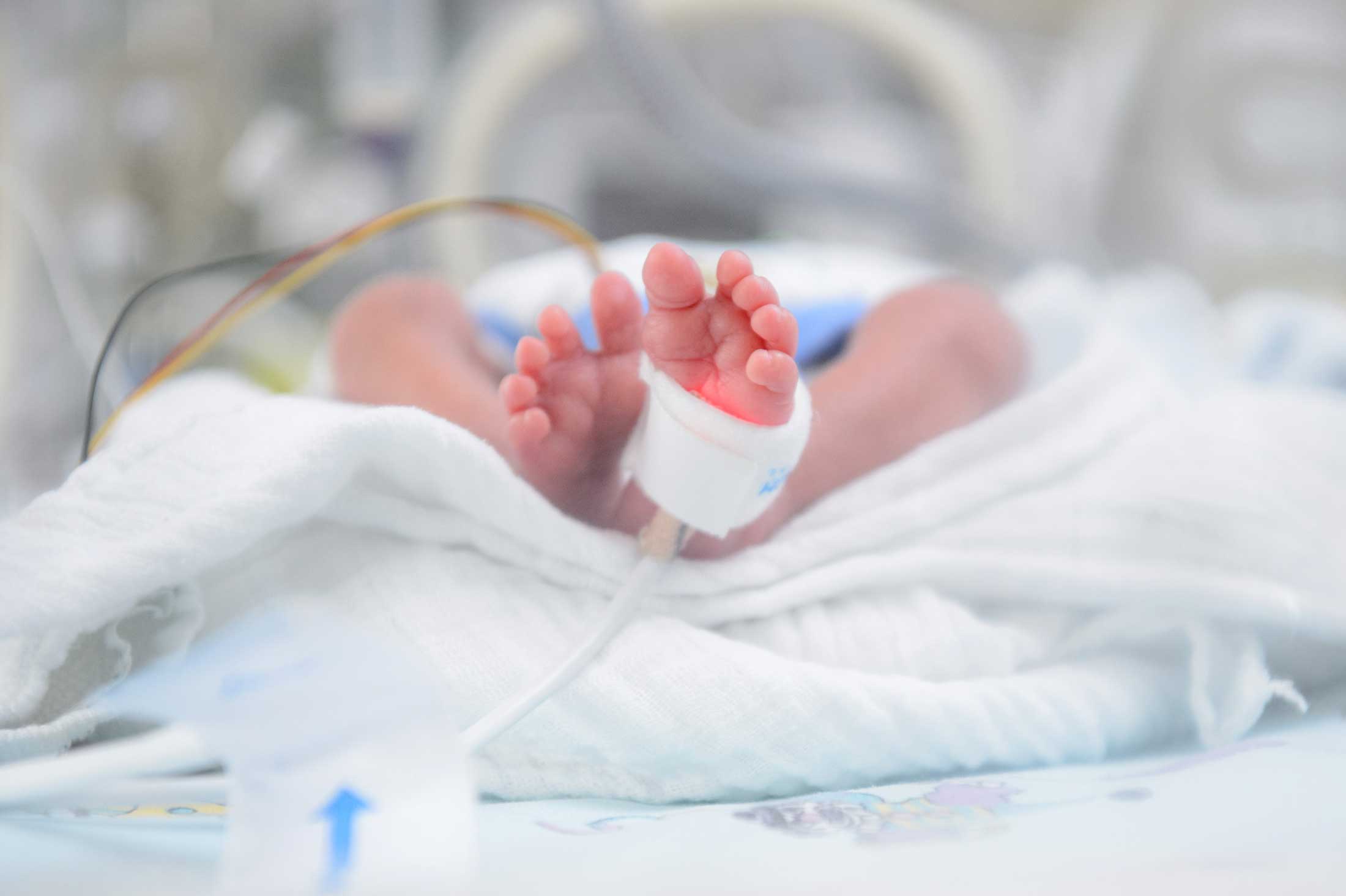 Nahaufnahme von Babyfüßen. Um einen der Füße ist ein Verband gewickelt, der offenbar ein Gerät zur Sauerstoffmessung fixiert. Die Füße liegen auf einem weißen Stofftuch. Im Hintergrund ist unscharf ein Inkubator zu erkennen, in dem das Kind liegt.
