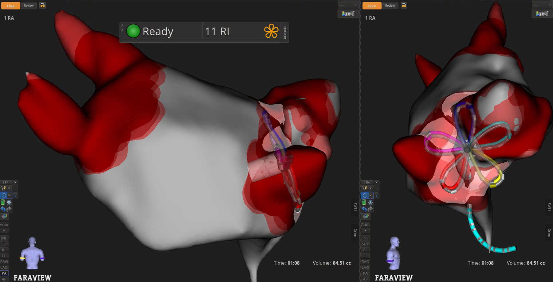 Screenshot einer PFA-Anwendung mit grauen und roten Bereichen sowie der bunten Darstellung einer blütenförmigen Sonde