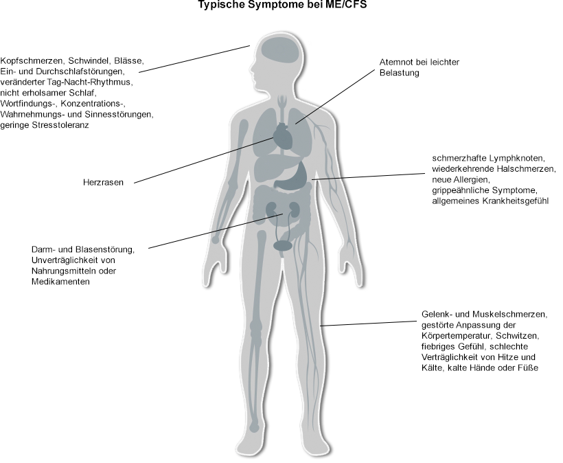 Universitätsklinikum Würzburg: SPZ: ME/CFS-Symptome