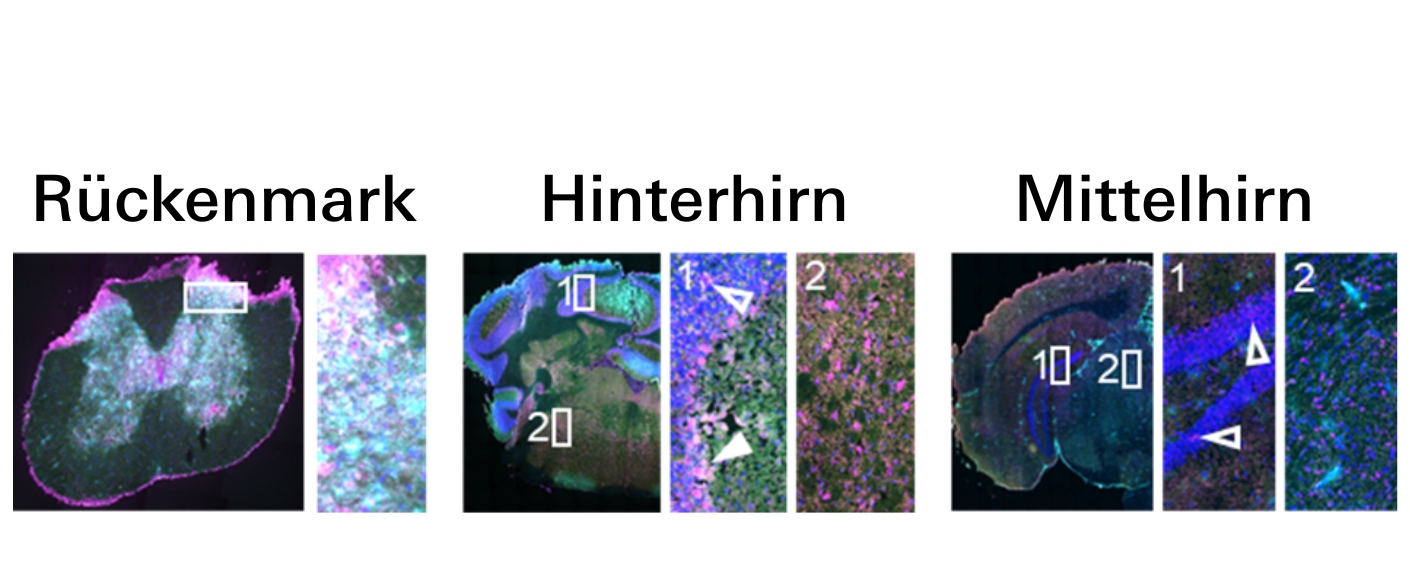 Stiff Person Syndrom Bindungsmuster von Autoantikörpern gegen verschiedene Gewebe des zentralen Nervensystems in der Maus, darunter Rückenmark, Hirnstamm und Hippocampus.
