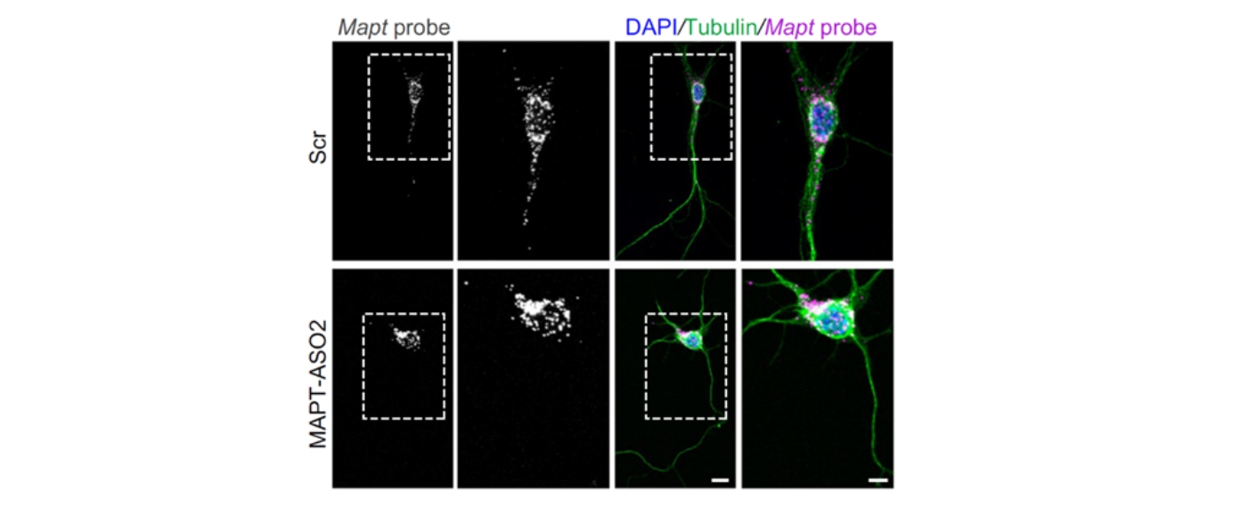 FISH - mRNA in Axonen nach ASO-Behandlung Mapt-FISH von DIV 6 unbehandelten (Ctrl) Maus-Hippocampusneuronen und Hippocampusneuronen, die mit Scramble-Oligonukleotid oder MAPT-ASO2 behandelt wurden. Maßstabsbalken: 10 und 5 µm (Einfügung).