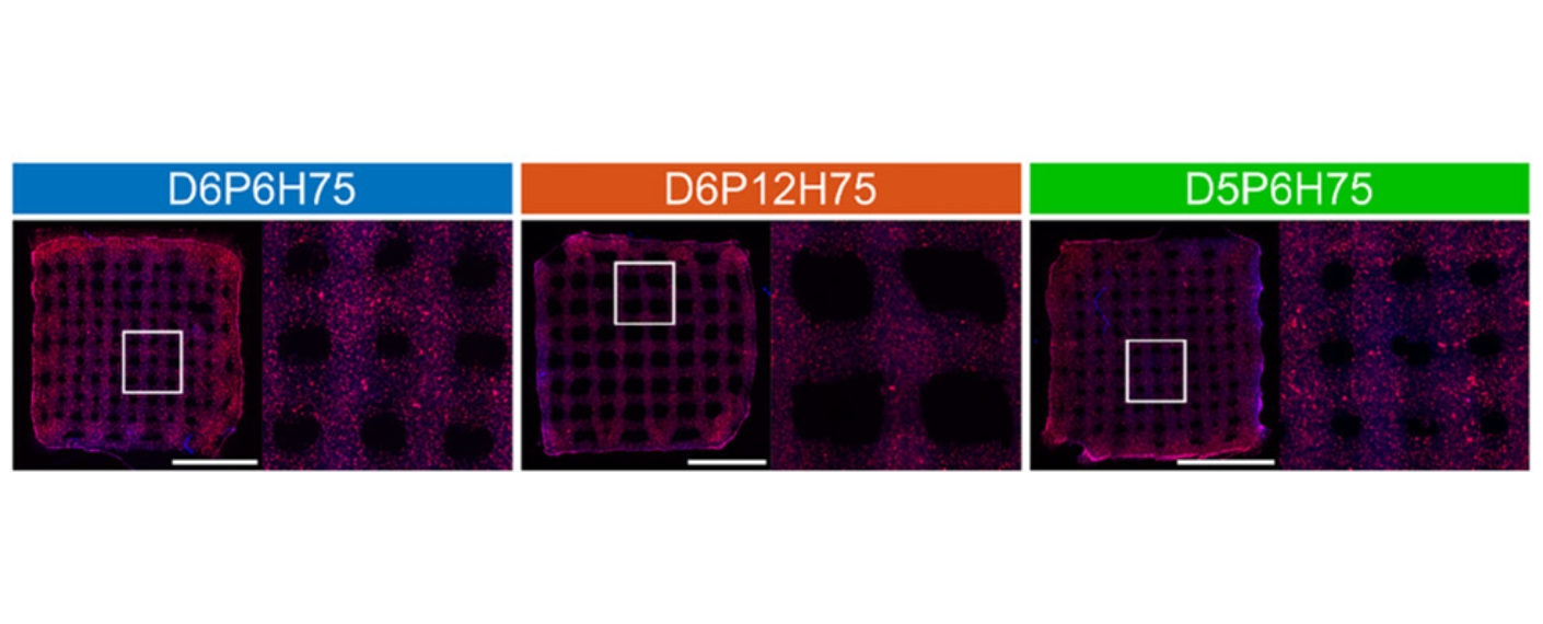 U87 Zellen in biogedruckten Mesostrukturen Fluoreszierende tdTomato (rot) transduzierte U87-Zellen, eingebettet in das Hydrogel. Das linke Bild zeigt die gesamte gedruckte makroporöse Mesostruktur, das rechte Bild zeigt die Vergrößerung des markierten Bereichs. Die Zellkerne wurden mit DAPI (blau) angefärbt. Maßstab 5 mm.