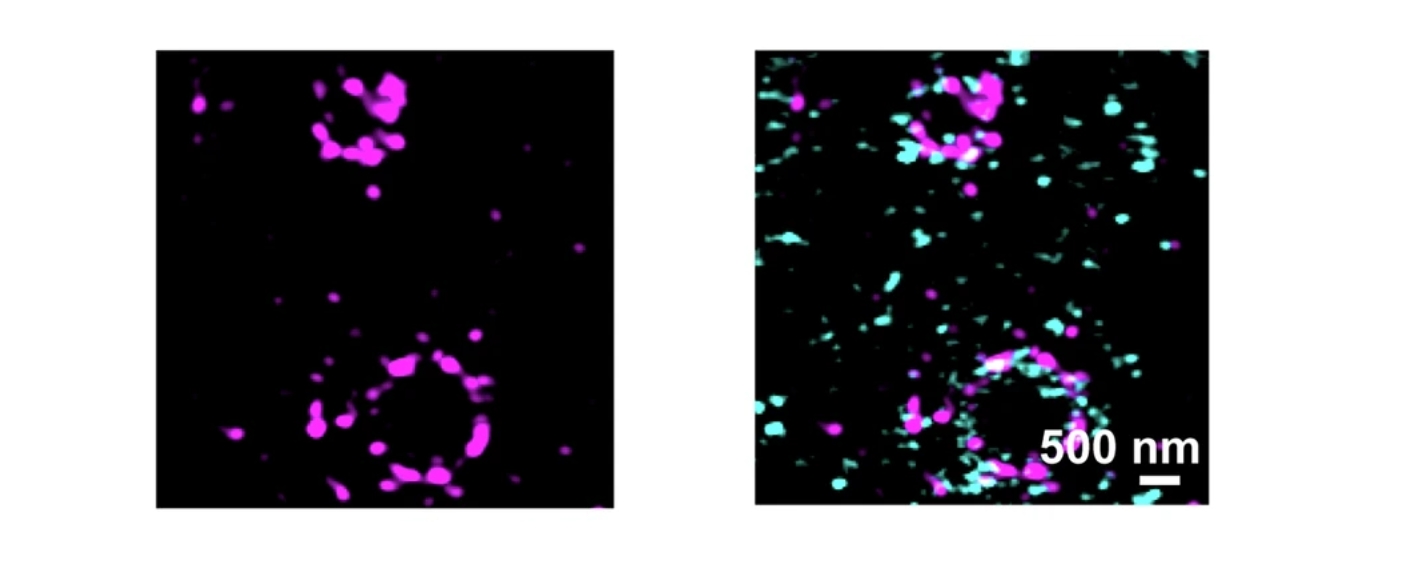 Lichtmikroskopie Munc 13-1 Protein Lattice-SIM zeigt supramolekulare Munc13-1-Cluster in präsynaptischen Membranen an den axonalen Wachstumskegeln kultivierter Motoneuronen. Einfügung auf der rechten Seite: Die Vergrößerung zeigt die Kolokalisierung von Munc13-1 mit Snap25 in supramolekularen Clustern.