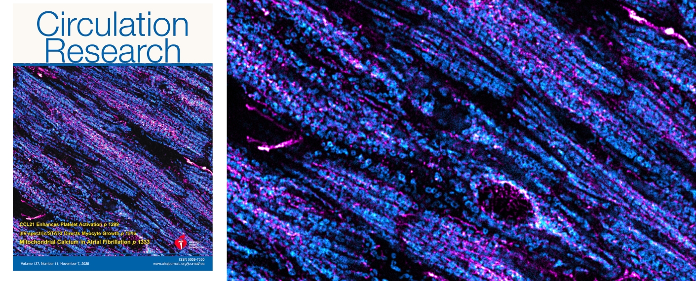 Collage vom Cover des Journals links und rechts ein Ausschnitt des Coverbildes mit den Mitochondrien. 