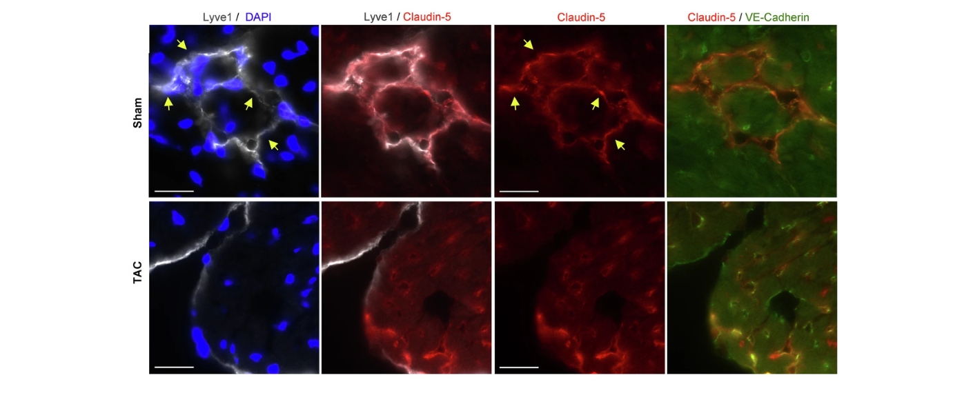 Mikroskopische Bilder aus der Publikation zur Veränderung des Lymphprofils nach einer Herzentzündung.