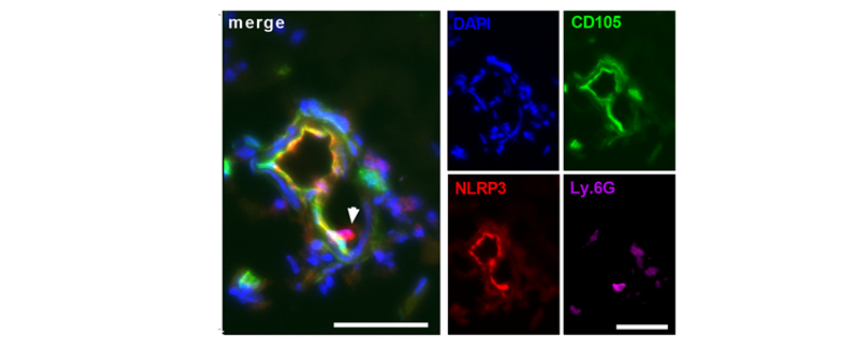 Multikanalfärbung des NLRP3 Inflammasoma
